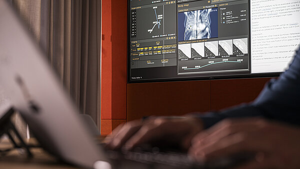 Foto: Im Vordergrund sieht man verschwommen einen aufgeklappten Computer und zwei Hände die auf der Tastatur schrieben. Im Hintergrund, aber auch im Fokus, sieht man ein Bildschirm auf dem ein KI Programm der Medizin zu sehen ist.