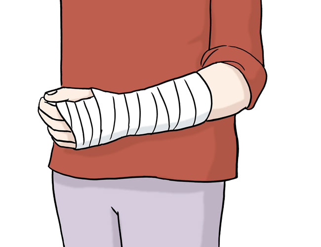 Verletzung am Arm