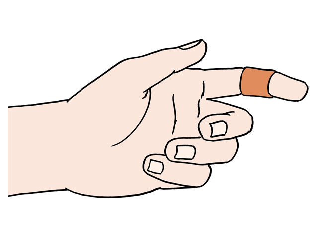 Verletzung am Finger